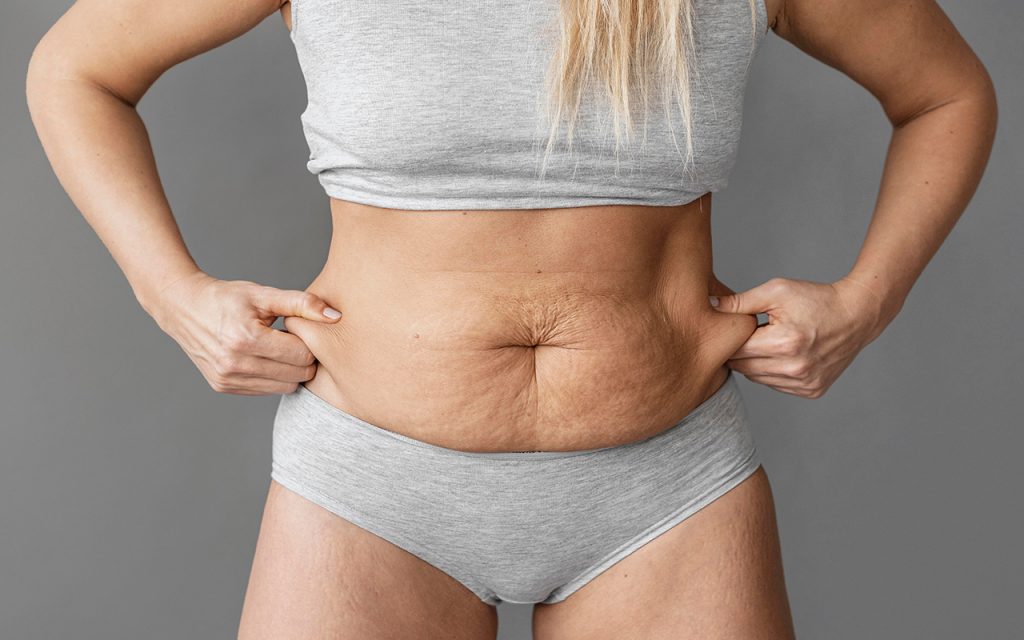 Abdominoplastie en Tunisie : un prix abordable avec hébergement inclus