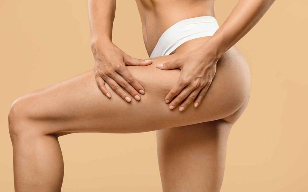 Zones ciblées par le lifting des cuisses