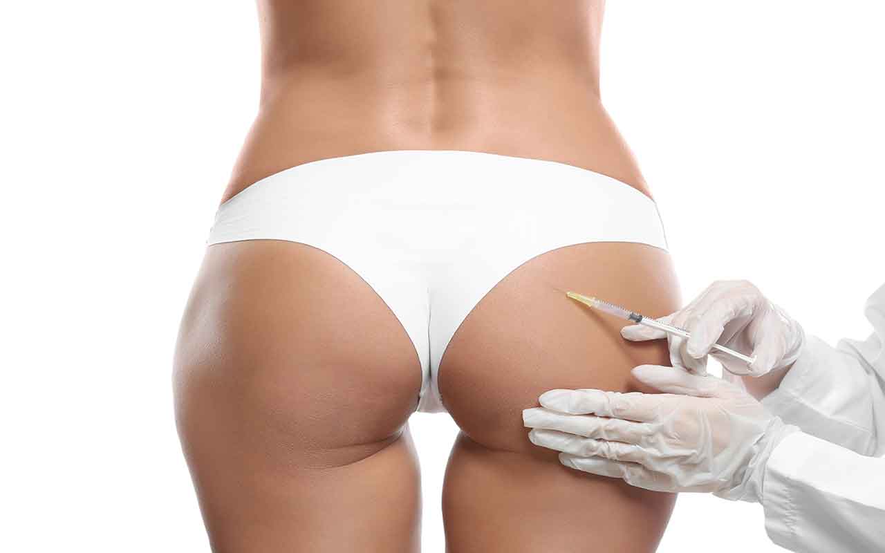Implants fessiers : avantages et inconvénients