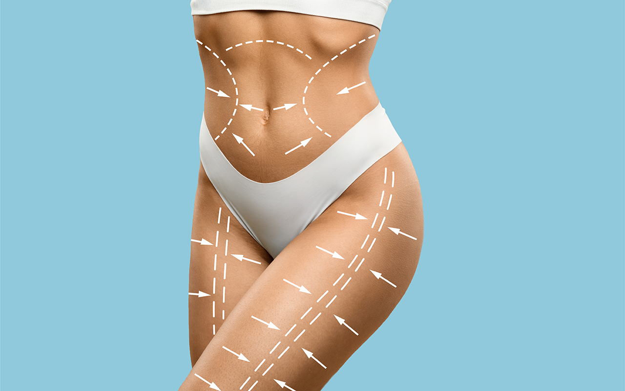 L’abdominoplastie – Retrouver un ventre plat et tonique
